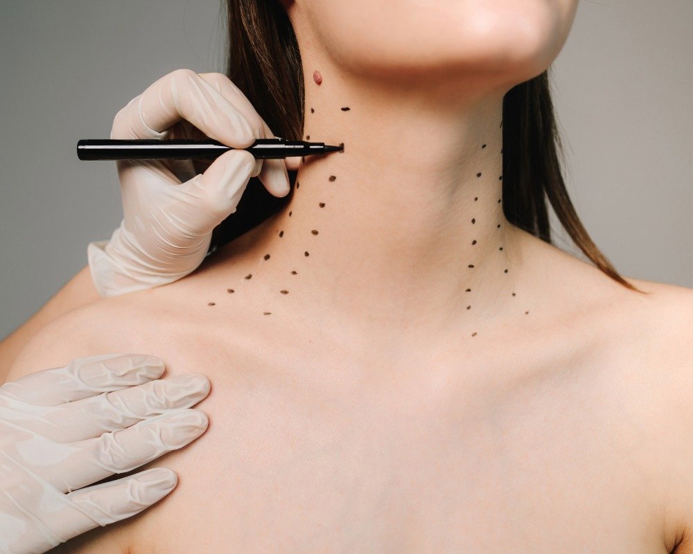 nefertiti-botoks-dr-ozlem-tosun